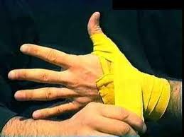 Желтые бинты на руках 2